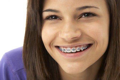 Những sai lầm gây hậu quả nghiêm trọng trong niềng răng - 2 Muốn niềng răng hiệu quả bác sĩ cần phải đưa ra những chỉ định điều trị phù hợp