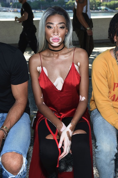 
Winnie Harlow gợi cảm đi xem show diễn của Kanye West
