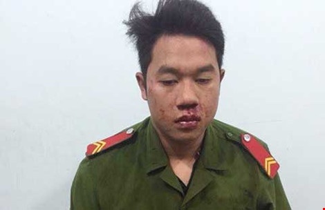 Rộ nạn giả danh công an ở Đồng Nai - 1 Phạm Văn Cường giả danh công an bị bắt giữ. Ảnh: TD