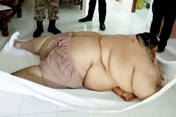Người đàn ông béo phì phải nhập viện bằng xe tải hạng nặng - 1
Một người đàn ông ở Malaysia nặng 317kg được cho lên cáng đưa vào bệnh viện