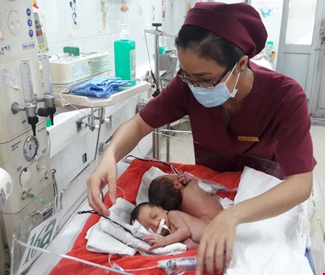 Hai bé song sinh dính liền mông, không thấy hậu môn - 2 Hai bé phải được chăm sóc kỹ lưỡng để tránh lở loét cơ thể, xoay trở bất lợi. Ảnh: HÀ PHƯỢNG