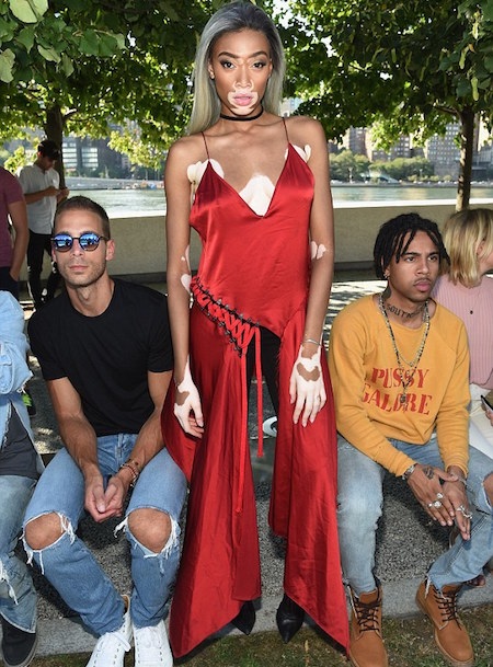 Tất-tần-tật về Winnie Harlow, “bóng hồng” mới của tay chơi Lewis Hamilton - 2 Chân dài 9x gây ấn tượng nhờ làn da hết sức đặc biệt