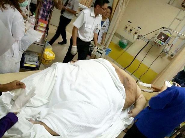 Người đàn ông béo phì phải nhập viện bằng xe tải hạng nặng - 3 Một ngày Sia ăn từ 20-30 bát mì cùng với rất nhiều đồ ngọt