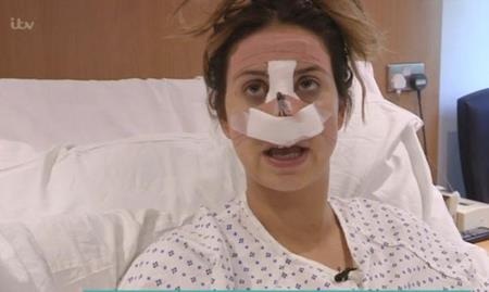 Kiều nữ Anh công khai hành trình “dao kéo” gây sốc - 3 Người đẹp đã công khai hành trình phẫu thuật thẩm mĩ