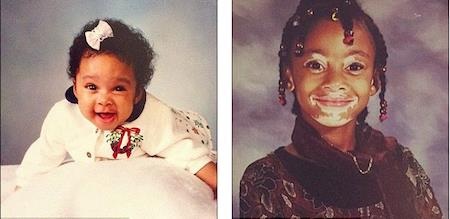 Tất-tần-tật về Winnie Harlow, “bóng hồng” mới của tay chơi Lewis Hamilton - 3 Winnie Harlow bị bệnh bạch biến từ khi còn rất nhỏ