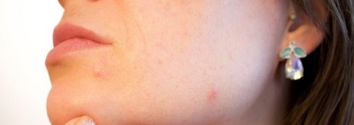 Bạn đang làm hỏng da mình với 17 thói quen sau - 4 Bạn đang làm hỏng da mình với 17 thói quen sau - 4