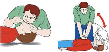 Sơ cứu đuối nước sai rất nguy hiểm - 1 Sơ cứu đuối nước sai rất nguy hiểm - 1