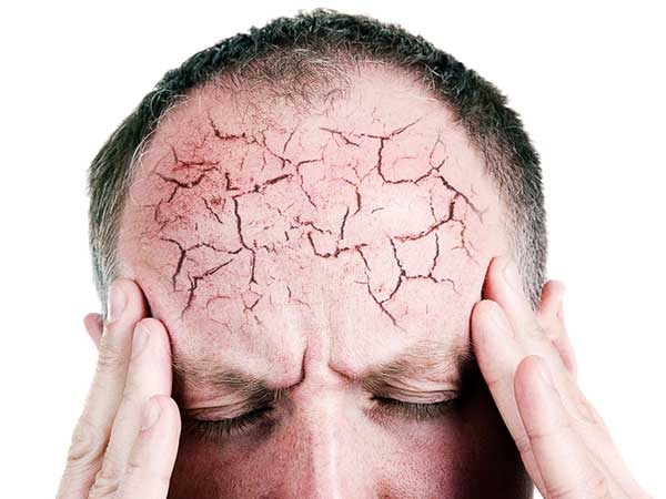 Dấu hiệu sớm sa sút trí tuệ không nên bỏ qua - 1 Dấu hiệu sớm sa sút trí tuệ không nên bỏ qua - 1