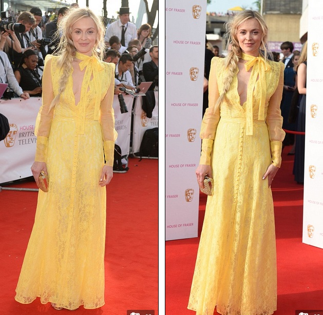 Những sao mặc xấu đến ngỡ ngàng - 3
Fearne Cotton kém sang trọng với bộ váy ren vàng