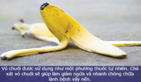 Mẹo hữu ích từ vỏ chuối ít khiến bạn bất ngờ - 8 Mẹo hữu ích từ vỏ chuối ít khiến bạn bất ngờ - 8
