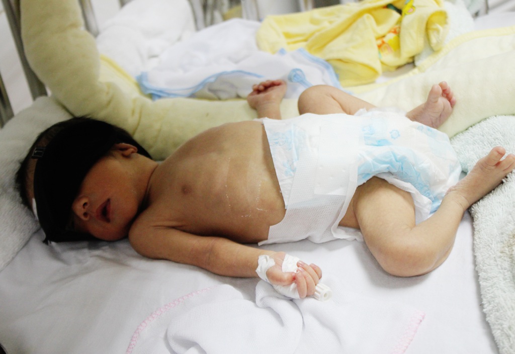 Thương bé sinh non khát sữa vì mẹ nguy kịch do xuất huyết não - 1 Ra đời bằng phương pháp mổ khi mẹ nguy kịch, bé trai (chưa kịp đặt tên) hiện vẫn đang phải nằm lồng ấp.