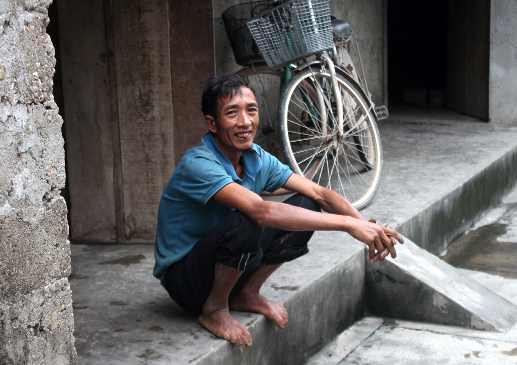 Cùng đường, mẹ bán cả tóc để cứu con mắc chứng thận hư - 3 Anh Nguyễn Danh Lưu bị khuyết tật về trí tuệ, hiện đang hưởng trợ cấp hàng tháng