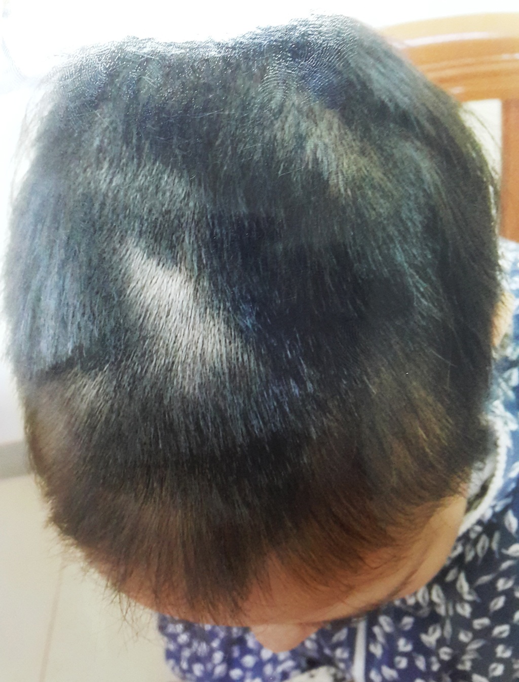 Trần tình của cô gái bị vợ của nhân tình thuê người cắt tóc, đánh ghen - 2 Mái tóc của P. bị cắt nham nhở nhưng rất may thai nhi không bị ảnh hưởng.