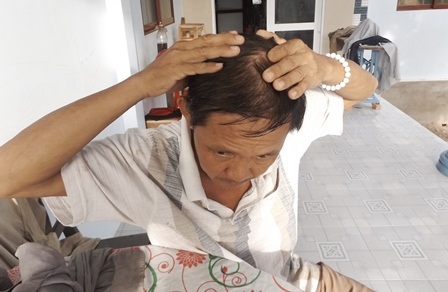 Ông Go cho rằng ông bị vợ dùng thanh gỗ đánh thẳng vào đầu nên mới có hành động bộc phát như vậy