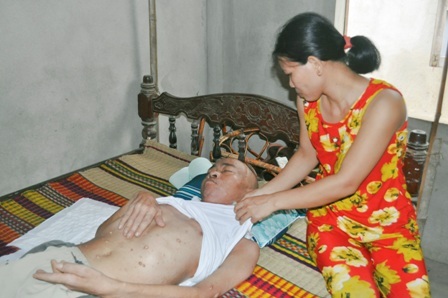 Dù đang mang căn bệnh ung thư nhưng chị Hiếu vẫn phải gồng gánh lo cho chồng con