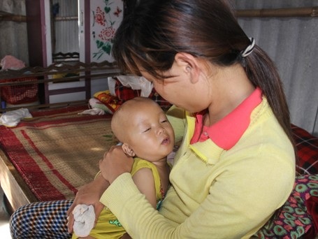 
Chị Phúc đau đớn mỗi khi thấy con mình kém ăn, ngủ, lên cơn co giật
