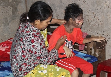 Trang chỉ sinh hoạt tại chỗ, mọi thứ đều do mẹ em chăm sóc