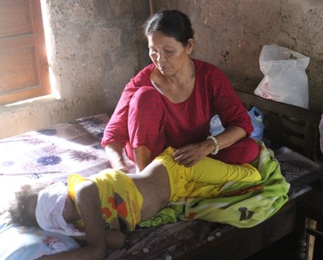 Quảng Trị: Trao hơn 85 triệu đồng đến em gái bị bệnh tật phá hủy gần hết khuôn mặt - 1