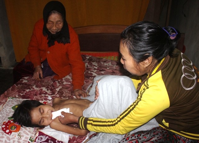 Mắc bệnh hiếm gặp, học sinh lớp 2 “đếm ngược” thời gian chờ chết! - 5