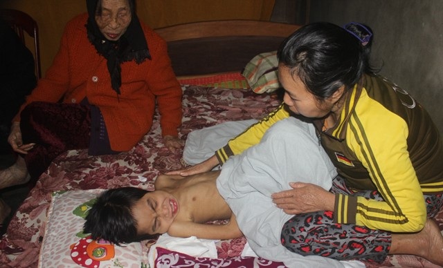 Mắc bệnh hiếm gặp, học sinh lớp 2 “đếm ngược” thời gian chờ chết! - 3