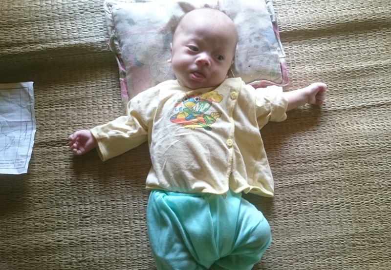 Bé Hà Văn Long thở rất khó nhọc vì căn bệnh tim bẩm sinh