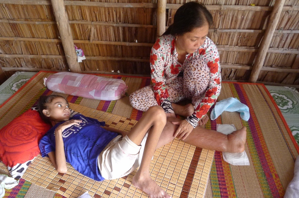 Mắc bệnh ung thư dạng hiếm, nữ sinh lớp 7 chỉ còn da bọc xương - 1
Căn bệnh quái ác đã biến cô học trọ to khỏe, học giỏi ngày nào thành một cô bé nằm liệt giường, cơ thể chỉ còn da bọc xương...