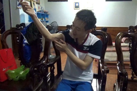 Vụ được BHYT chi trả hơn 1,6 tỷ đồng:“Bảo hiểm y tế đã cứu cuộc đời tôi” - 2 Anh Dũng chỉ phần cổ tay hoại tử đã được phẫu thuật hồi tháng 2/2015.