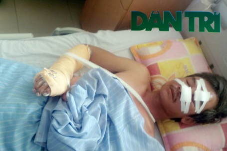 
Làm ăn lương thiện, nhưng anh Đào Viết Quang đã bị kẻ tranh giành lãnh địa chém đến nhập viện.
