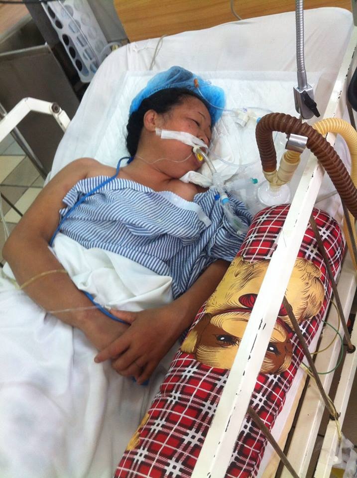 Bệnh nhân suýt liệt cơ hô hấp do bị rắn cắn lúc ngủ trưa - 1 Bệnh nhân suýt liệt cơ hô hấp do bị rắn cắn lúc ngủ trưa - 1