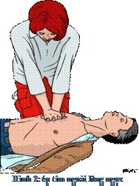 Gặp người tai nạn giao thông, ứng cứu như thế nào? - 1 Động tác ép tim