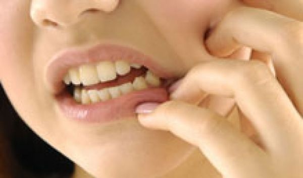 Hàng loạt “rắc rối” vì răng khôn - 1 Hàng loạt “rắc rối” vì răng khôn - 1