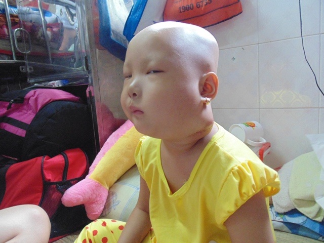 Sự sống mong manh của bé gái 5 tuổi mắc chứng ung thư hạch - 4 Mong ước mỗi ngày của em là được về chơi với em Bo ở nhà