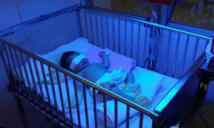 Bé gái 2 ngày tuổi bị mẹ cắn cụt đốt ngón tay - 1
Bé gái đang được các bác sĩ chăm sóc tại Bệnh viện Nhi đồng Đồng Nai.