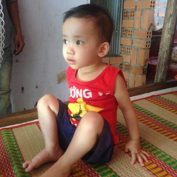 Bé Dương Thị Quỳnh Anh mang trong mình nhiếu căn bệnh từ khi mới hơn 1 tháng tuổi