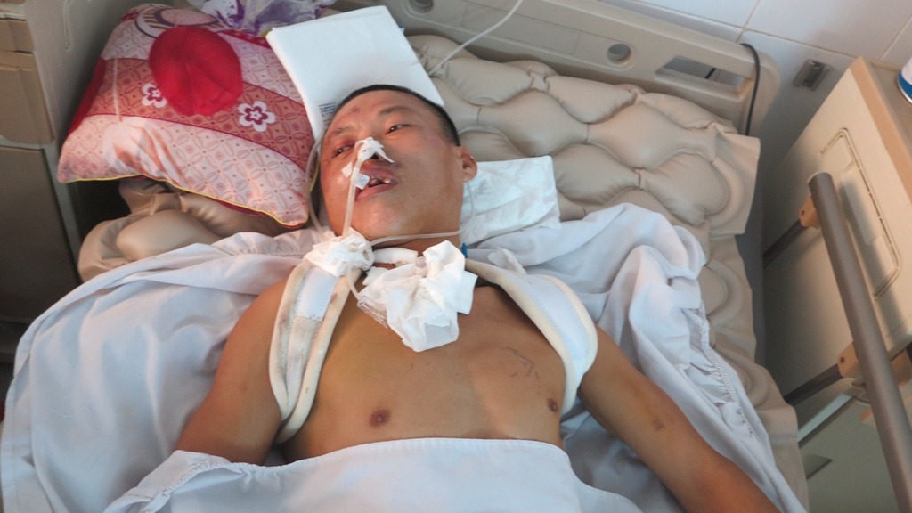 Hiện tại anh Hùng đã tỉnh lại nhưng vẫn không nhận thức được sự việc xung quanh, sự sống của anh được duy trì bằng máy móc.