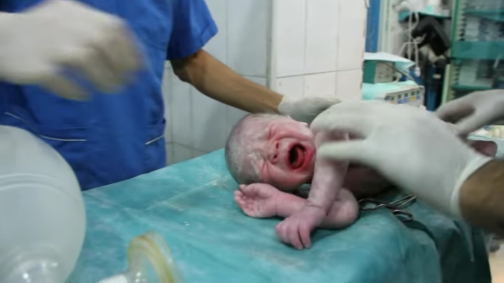 Ca “vượt cạn” kỳ diệu của sản phụ bị thương sau trận không kích ở Syria - 1 Đứa trẻ được hạ sinh sau khi sản phụ Mayissa bị thương do trúng bom ở Syria (Ảnh cắt từ clip)