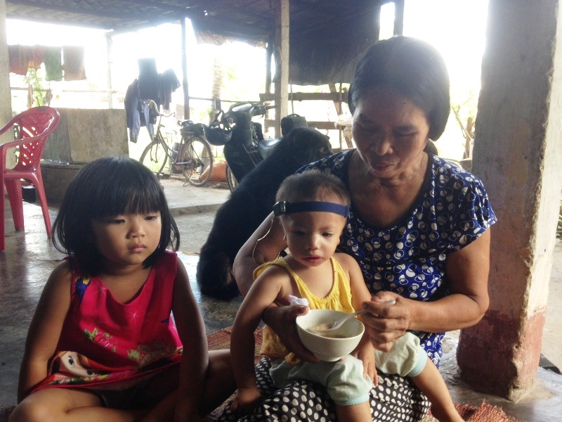 Thương bé 19 tháng tuổi không có vành tai, hở hàm ếch - 6 Do bị hở hàm ếch từ lúc mới sinh ra nên bé Thanh Tấm rất khó ăn uống