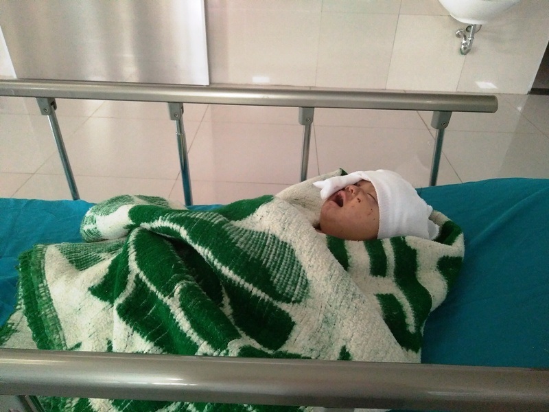 Hiện tại bé Thanh Tùng đã qua khỏi cơn nguy kịch