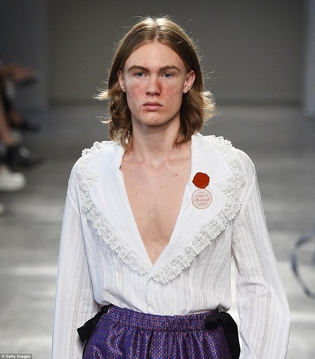 Dàn mẫu mặt chi chít “đèn pin”… đổ bộ sàn catwalk - 4