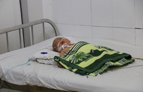 Bé trai 5 tháng tuổi là trường hợp nhiễm não mô cầu đầu tiên tại tỉnh Đắk Lắk