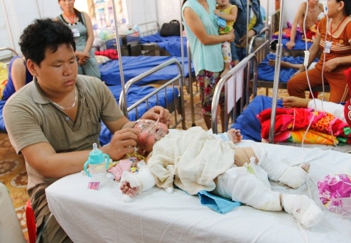 Bị ngăn cấm yêu em gái vợ 13 tuổi, chồng mang xăng đốt cả nhà - 2 Con trai của Lộc bị cha đốt bỏng 40%