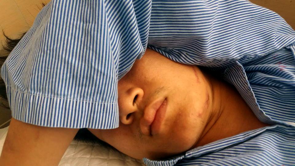 Hà Nội: Nam thanh niên nhập viện sau khi bị đưa về công an xã - 3 Tùng đang được điều trị tại Bệnh viện đa khoa Đức Giang.