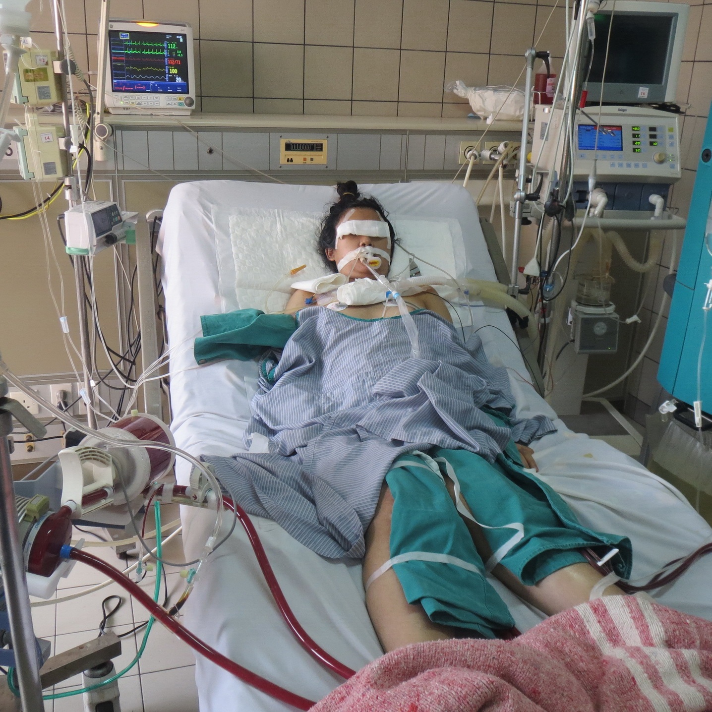 Nam sinh viên nghèo chạy xe ôm giúp bạn chữa trọng bệnh - 2
Bạn của Quý, Phùng Thiều Lam nằm hôn mê trên giường bệnh. (Ảnh: P. Bình)