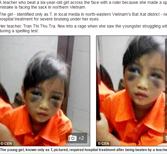 
Hình ảnh và vụ việc học sinh bị giáo viên đánh tím mặt trên báo Dailymail.
