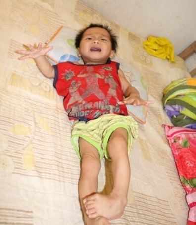 Trao hơn 87 triệu đồng đến gia đình em Thái Thị Mỹ - 1 Mới hai tuổi nhưng bé Mỹ đã mang căn bệnh teo não và viêm phổi nặng