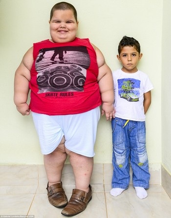 Cậu bé 5 tuổi nặng... hơn 80kg - 1 Cậu bé Misael có kích cỡ và khối lượng gấp 3 lần những cậu bé ở cùng độ tuổi