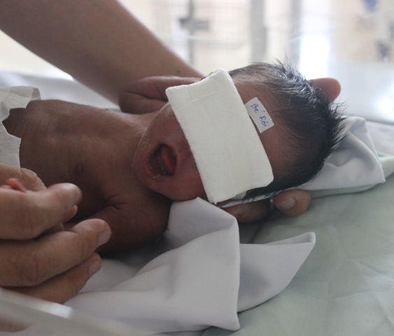 Xót thương bé gái đẻ non mắc bệnh tim bẩm sinh bị bố mẹ bỏ rơi - 3 Cái miệng chốc chốc lại huơ huơ như cố tìm kiếm bầu vú của mẹ trông đến tội nghiệp