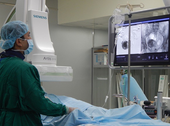 Phương pháp mới điều trị u xơ tử cung nhanh phục hồi, thẩm mỹ - 1 Phương pháp mới điều trị u xơ tử cung nhanh phục hồi, thẩm mỹ - 1