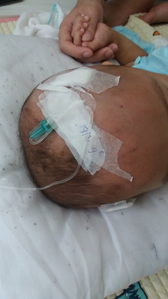 Xót xa nhìn bé trai 9 tháng tuổi bị ung thư máu khóc không thành tiếng - 4 Phải truyền thuốc nhiều nên cháu chịu không nổi
