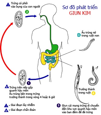 Bé gái tiểu dầm: Truy tầm giun kim - 1 Bé gái tiểu dầm: Truy tầm giun kim - 1